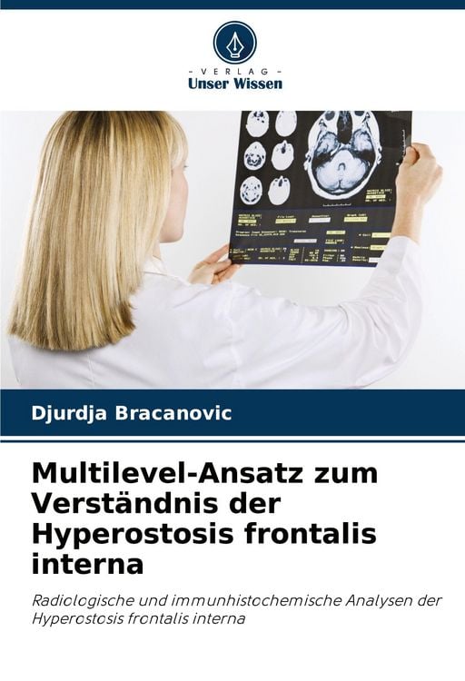 Produktbild: Multilevel-Ansatz zum Verst&auml;ndnis der Hyperostosis frontalis interna