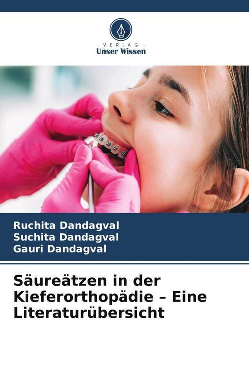 Produktbild: S&auml;ure&auml;tzen in der Kieferorthop&auml;die - Eine Literatur&uuml;bersicht