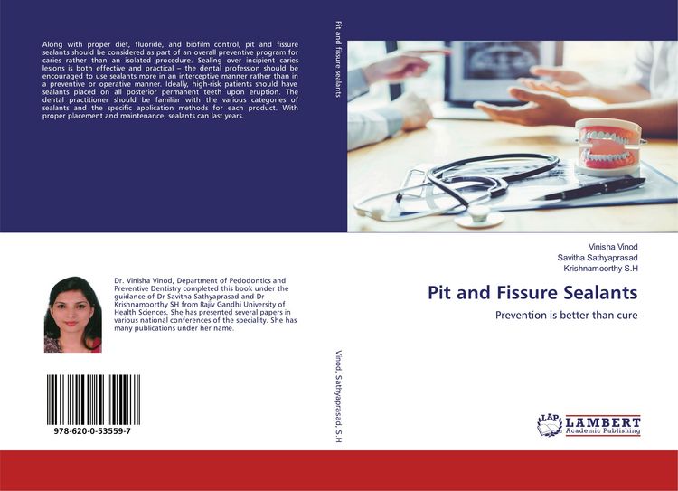 Produktbild: Pit and Fissure Sealants