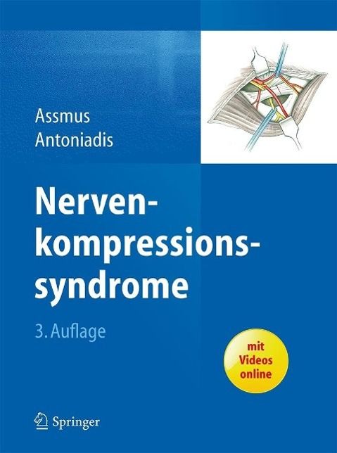 Produktbild: Nervenkompressionssyndrome