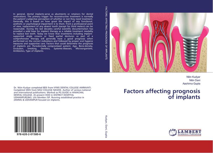 Produktbild: Factors affecting prognosis of implants