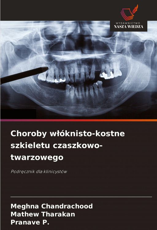 Produktbild: Choroby w&iquest;&oacute;knisto-kostne szkieletu czaszkowo-twarzowego