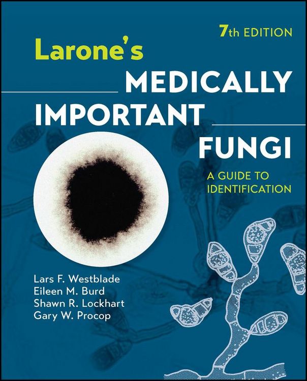Produktbild: Larone's Medically Important Fungi