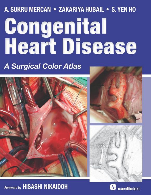 Produktbild: Congenital Heart Disease: A Surgical Color Atlas