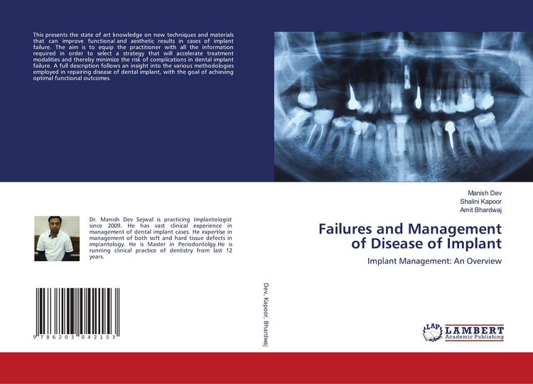 Produktbild: Failures and Management of Disease of Implant