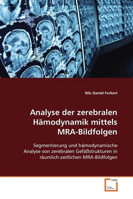 Produktbild: Forkert, N: Analyse der zerebralen H&auml;modynamik mittels MRA-B