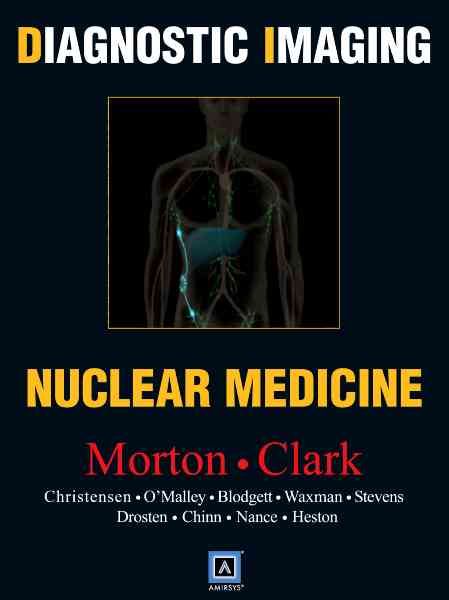 Produktbild: Diagnostic Imaging: Nuclear Medicine