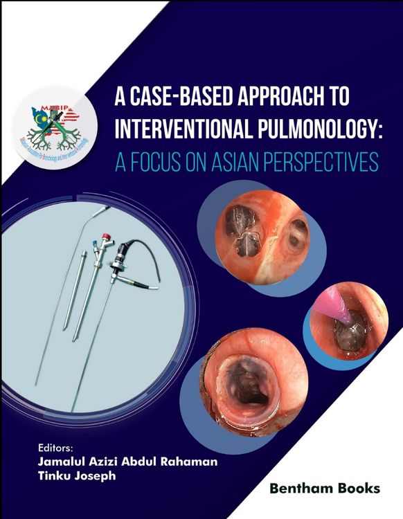 Produktbild: A Case-Based Approach to Interventional Pulmonology: A Focus on Asian Perspectives