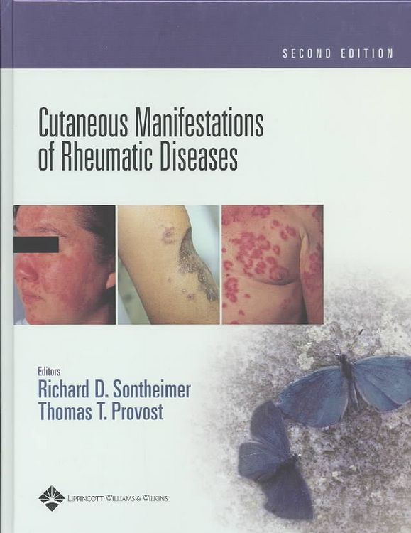 Produktbild: Cutaneous Manifestations of Rheumatic Diseases