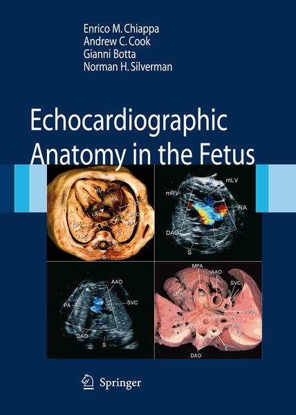 Produktbild: Echocardiographic Anatomy in the Fetus