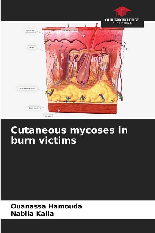 Produktbild: Cutaneous mycoses in burn victims