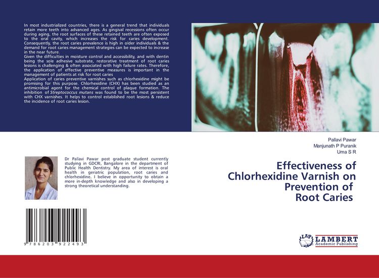 Produktbild: Effectiveness of Chlorhexidine Varnish on Prevention of Root Caries