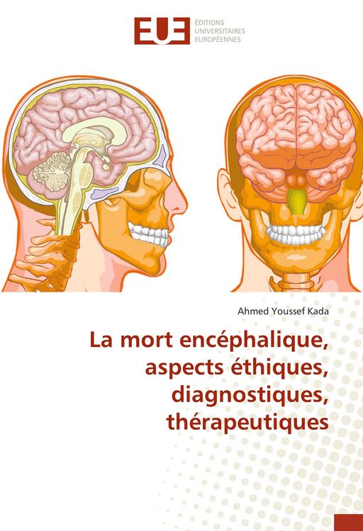 Produktbild: La mort enc&eacute;phalique, aspects &eacute;thiques, diagnostiques, th&eacute;rapeutiques