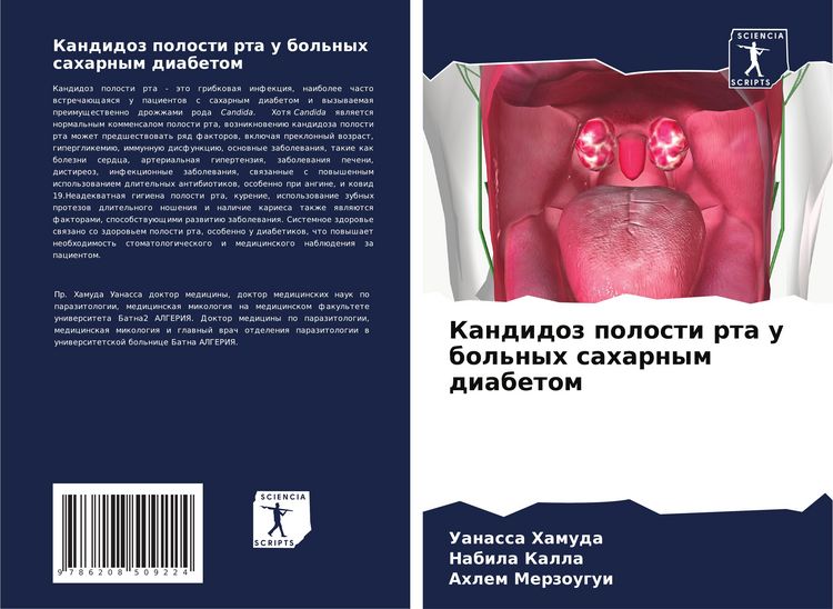 Produktbild: Kandidoz polosti rta u bol'nyh saharnym diabetom