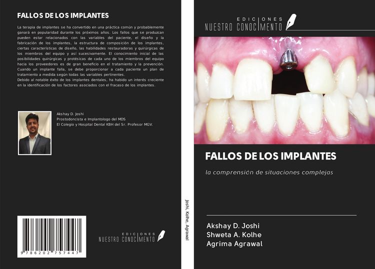 Produktbild: Fallos De Los Implantes