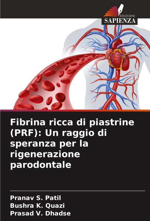 Produktbild: Fibrina ricca di piastrine (PRF): Un raggio di speranza per la rigenerazione parodontale
