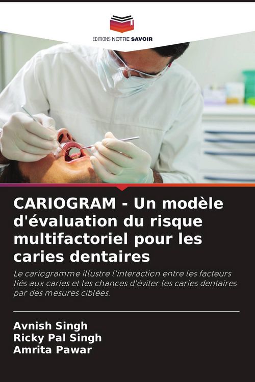 Produktbild: CARIOGRAM - Un mod&egrave;le d'&eacute;valuation du risque multifactoriel pour les caries dentaires