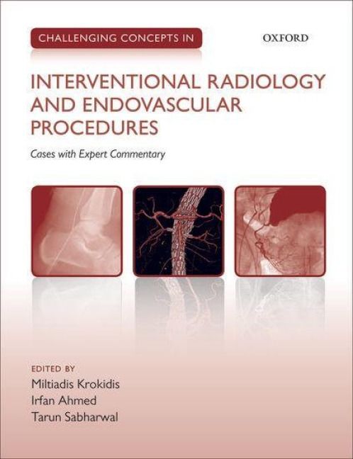 Produktbild: Challenging Concepts in Interventional Radiology
