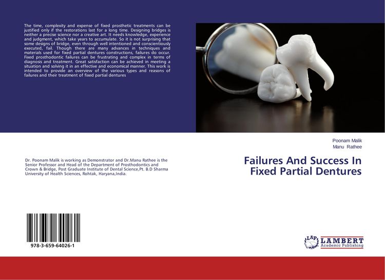 Produktbild: Failures And Success In Fixed Partial Dentures