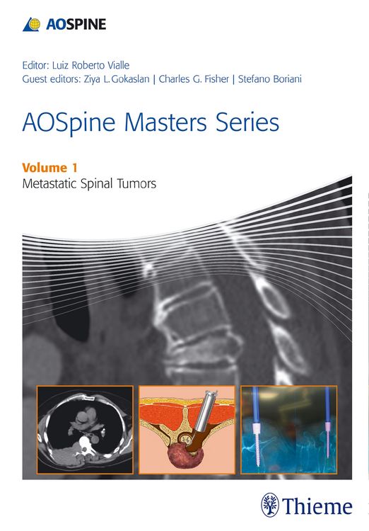 Produktbild: AOSpine Masters Series Volume 1: Metastatic Spinal Tumors