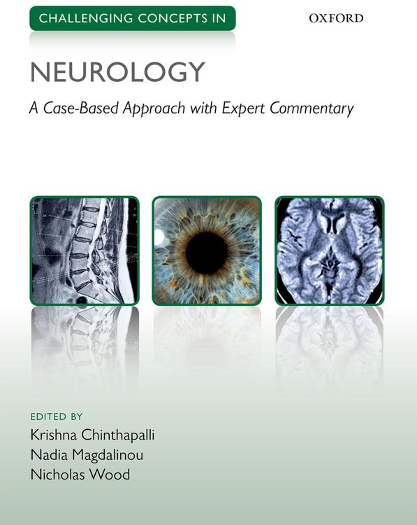 Produktbild: Challenging Concepts in Neurology
