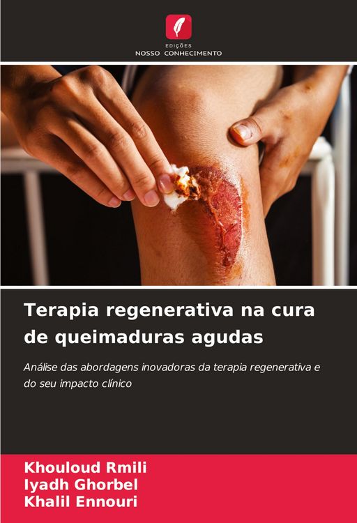 Produktbild: Terapia regenerativa na cura de queimaduras agudas