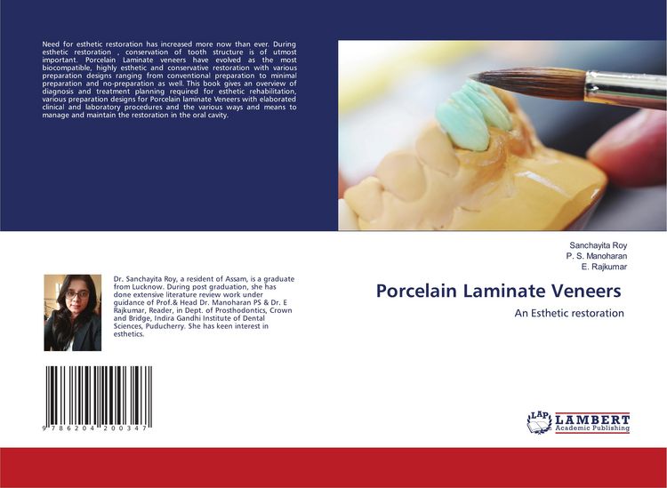 Produktbild: Porcelain Laminate Veneers