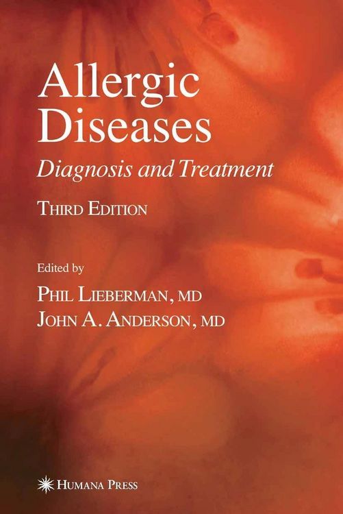 Produktbild: Allergic Diseases