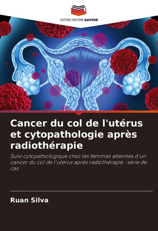 Produktbild: Cancer du col de l'ut&eacute;rus et cytopathologie apr&egrave;s radioth&eacute;rapie