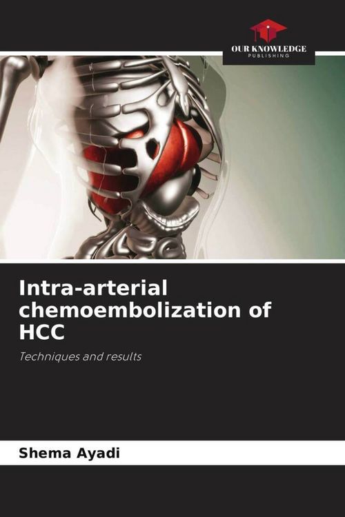 Produktbild: Intra-arterial chemoembolization of HCC