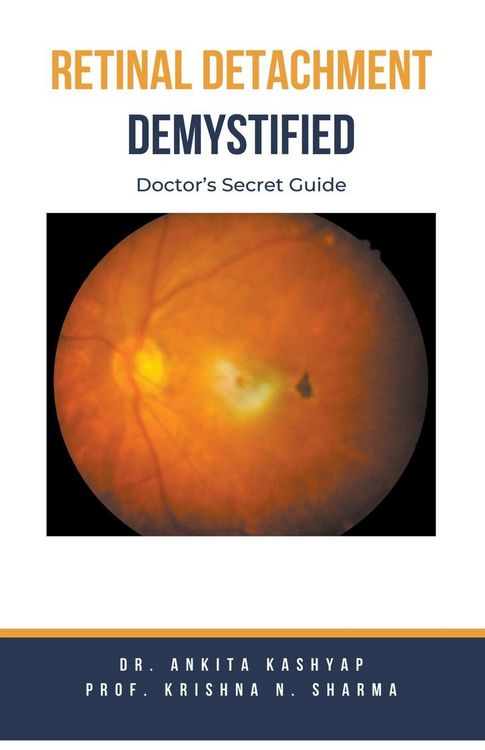 Produktbild: Retinal Detachment Demystified
