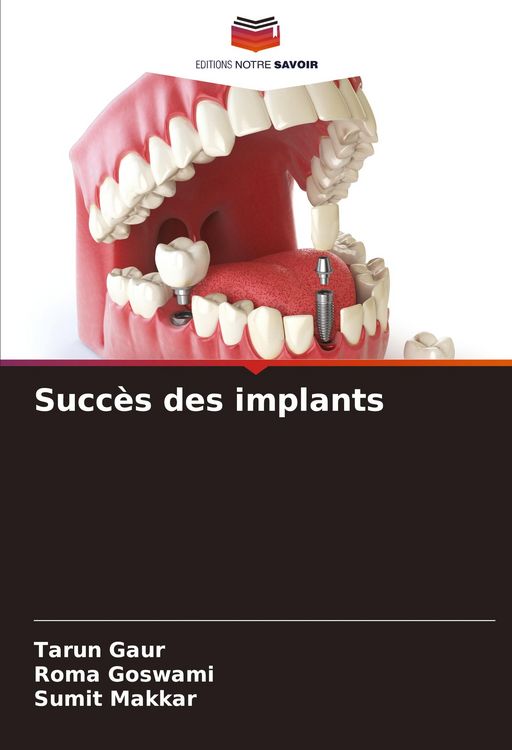 Produktbild: Succ&egrave;s des implants