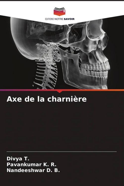 Produktbild: Axe de la charni&egrave;re