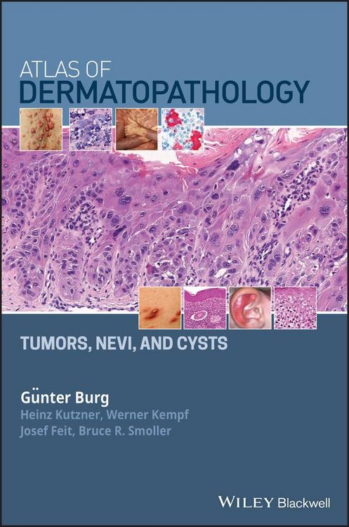 Produktbild: Atlas of Dermatopathology