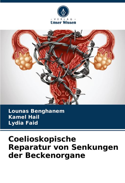 Produktbild: Coelioskopische Reparatur von Senkungen der Beckenorgane