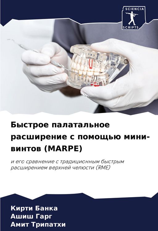 Produktbild: Bystroe palatal'noe rasshirenie s pomosch'&uuml; mini-wintow (MARPE)