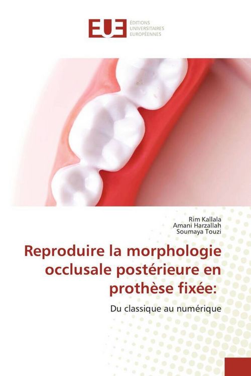 Produktbild: Reproduire la morphologie occlusale post&eacute;rieure en proth&egrave;se fix&eacute;e:
