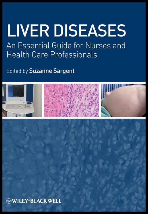 Produktbild: Liver Diseases