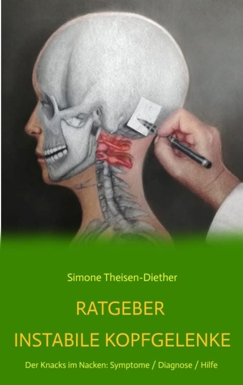 Produktbild: Ratgeber Instabile Kopfgelenke