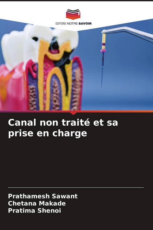 Produktbild: Canal non trait&eacute; et sa prise en charge