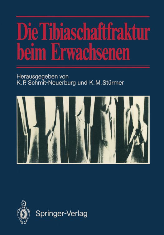 Produktbild: Die Tibiaschaftfraktur beim Erwachsenen