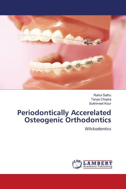 Produktbild: Periodontically Accerelated Osteogenic Orthodontics