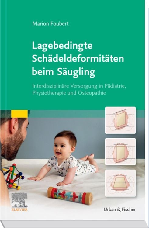 Produktbild: Lagebedingte Sch&auml;deldeformit&auml;ten beim S&auml;ugling