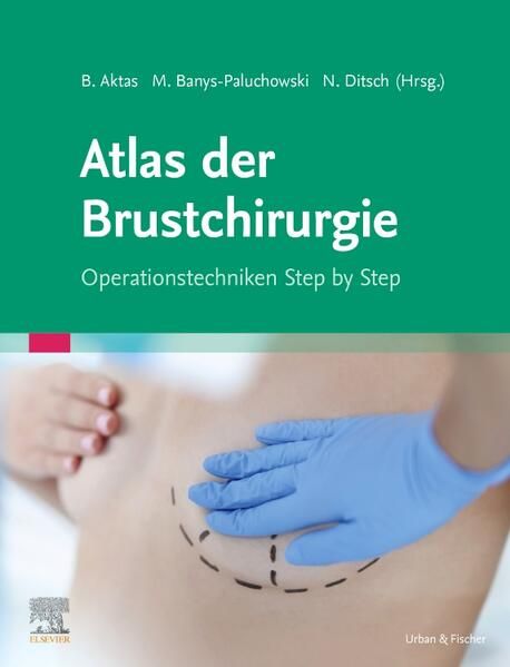 Produktbild: Atlas der Brustchirurgie