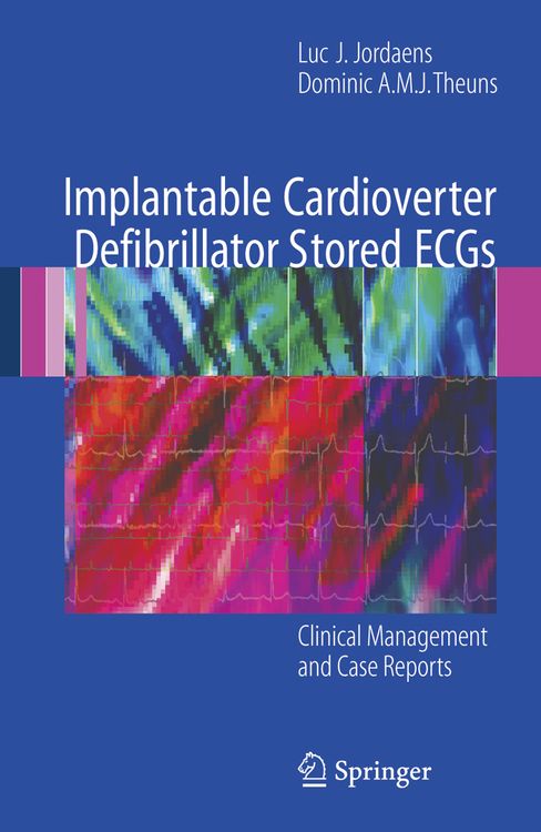 Produktbild: Implantable Cardioverter Defibrillator Stored ECGs