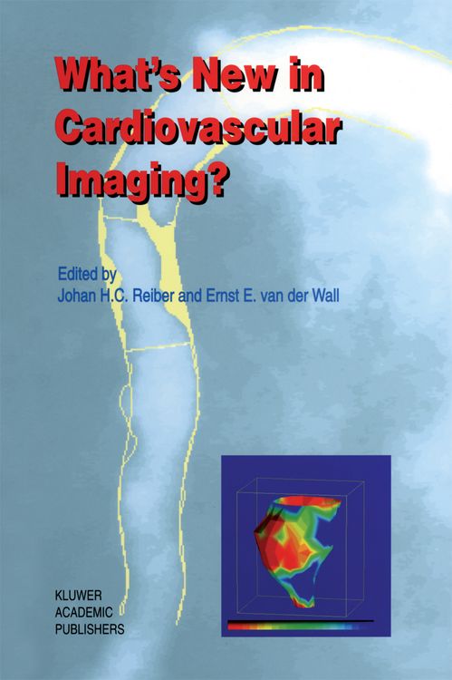 Produktbild: What&rsquo;s New in Cardiovascular Imaging?