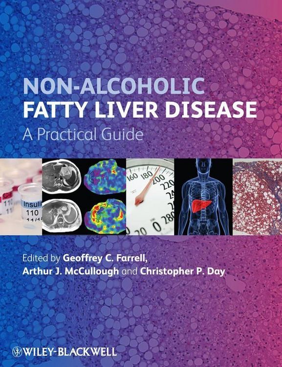 Produktbild: Non-Alcoholic Fatty Liver Disease