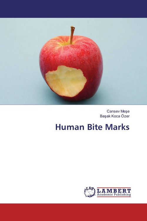 Produktbild: Human Bite Marks
