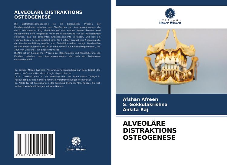 Produktbild: Alveol&auml;re Distraktions Osteogenese