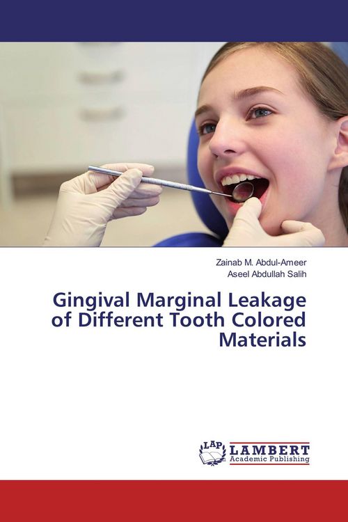 Produktbild: Gingival Marginal Leakage of Different Tooth Colored Materials